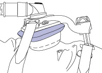 fitting-guide_mirage-activa-lt-7